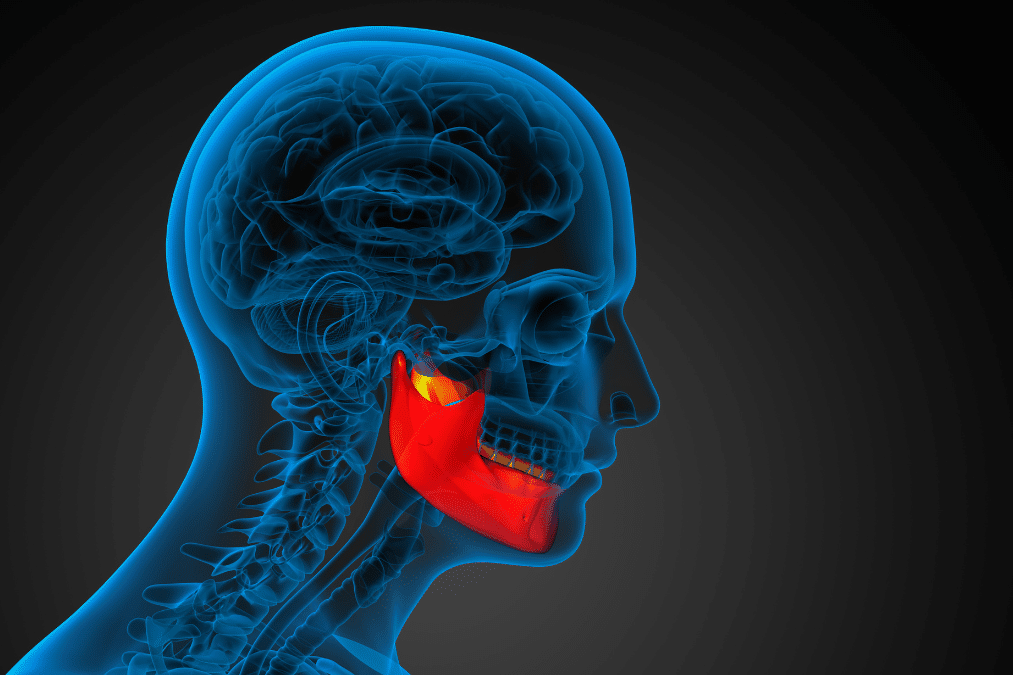 X-ray of jaw